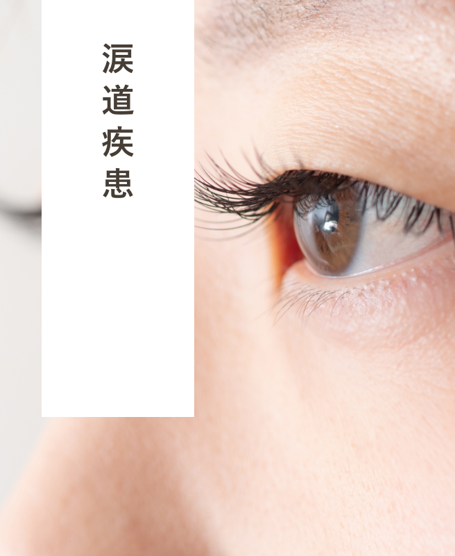 涙道疾患