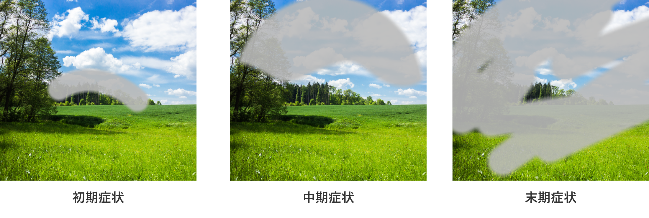症状