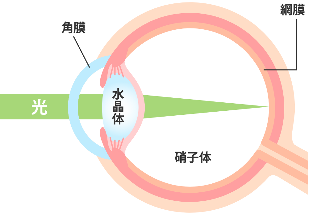 白内障 正常