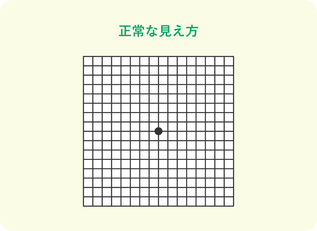 正常な見え方
