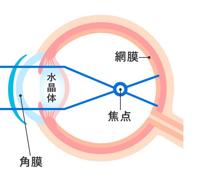 近視の状態