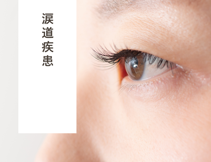 涙道疾患